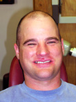 Dr. Schoonover -- Implant Crowns (Before)