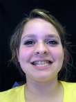 Dr. Schoonover -- Orthodontics (Before)