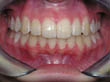 Dr. Schoonover -- Orthodontics (After)