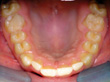 Dr. Schoonover -- Orthodontics (After)