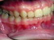 Dr. Schoonover -- Orthodontics (After)