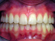 Dr. Schoonover -- Orthodontics (After)