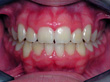 Dr. Schoonover -- Orthodontics (After)