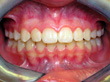 Dr. Schoonover -- Orthodontics (After)