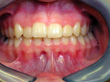 Dr. Schoonover -- Orthodontics (After)