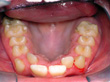 Dr. Schoonover -- Orthodontics (Before)